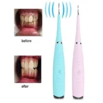 Dentalni skaler