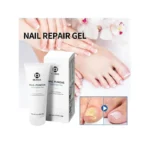 Gel protiv gljivica